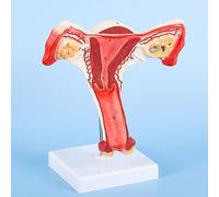 Modèle anatomique de l'utérus - Simulation naturelle claire de l'utérus et de l'ovaire pour la communication et l'enseignement médical des médecins et des patients