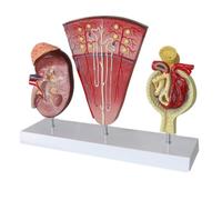 Modèle Anatomique de Rein Humain avec Structure urinaire et glomérulaire, modèle d'organe pour l'éducation médicale