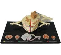Modèle anatomique de section transversale de la moelle épinière | Modèle anatomique de segment de colonne vertébrale humaine et vaisseaux sanguins, for l'enseignement en faculté de médecine