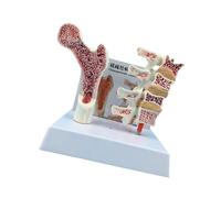 Modèle anatomique de vertèbres d'ostéoporose pour l'éducation anatomique et l'étude de la colonne vertébrale du patient Outil d'apprentissage médical Anatomie humaine