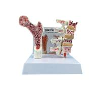 Modèle Anatomique De Vertèbres D'ostéoporose Pour L'éducation Et L'étude De La Colonne Vertébrale Du Patient Vertèbres Squelette Ostéoporose Colonne Vertébrale Fournitures