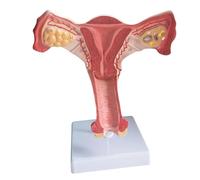 Modèle anatomique d'organe reproducteur interne féminin - Modèle réaliste d'anatomie d'organe reproducteur féminin pour l'enseignement de l'équipement de formation à l'hôpital