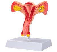 Modèle anatomique d'ovaire de l'utérus féminin, modèle de procréation utérine pathologique, outil d'enseignement vaginal de l'ovaire utérin, for les démonstrations de formation(19.5 * 17 * 6CM)