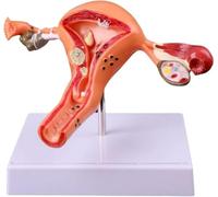 Modèle anatomique d'ovaire de l'utérus féminin, modèle de procréation utérine pathologique, outil d'enseignement vaginal de l'ovaire utérin, for les démonstrations de formation(22 * 11.5 * 7CM)