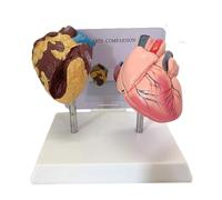 Modèle anatomique du cœur fumeur et du cœur sain, ensemble d'affichage comparatif des maladies cardiaques avec outil pédagogique médical de base Humain Amovible des