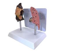 Modèle anatomique du poumon et du poumon pour l'enseignement de la substance PVC clinique en salle de classe démonstration de structure respiratoire Modèle d'enseignement