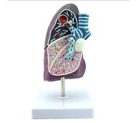 Modèle Anatomique du poumon Humain Tuberculose pathologique Pneumonie du Fumeur pour médecin, Bureau, Salle de Classe, f