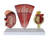 Modèle Anatomique du Rein - Modèle d'anatomie d'organe Humain Modèle d'unité rénale Humaine Modèle de système urinaire glomérulaire - pour l'aide éducative médicale
