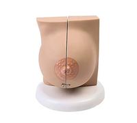 Modèle Anatomique du Sein Modèle Anatomique d'organe Humain Modèle de Sein féminin Modèle Anatomique pathologique médical Coupe transversale du Sein Modèle Anatomique Étude Enseignement Modèle(C)