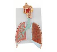 Modèle anatomique du système respiratoire humain, modèle de poumons des voies respiratoires de l'arbre bronchique droit des alvéoles, modèle de poumon humain, modèle du système respiratoire