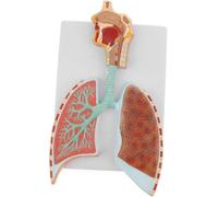 Modèle anatomique du système respiratoire humain - Représentation détaillée des alvéoles et de l'arbre bronchique à des fins pédagogiques