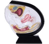 Modèle Anatomique d'utérus féminin Transparent, modèle d'utérus, modèle d'enseignement du Bassin et du Rectum, pour l'enseignement et la Formation médicale(Black)
