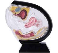 Modèle anatomique d'utérus féminin transparent, modèle pédagogique représentant l'utérus, le bassin et le rectum, destiné à l'enseignement et à la formation en médecine(Black)