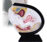 Modèle anatomique d'utérus féminin transparent, modèle pédagogique représentant l'utérus, le bassin et le rectum, destiné à l'enseignement et à la formation en médecine