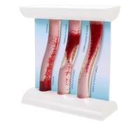 Modèle Anatomique Dynamique de Vaisseaux Sanguins, Enseignement Médical | Hips Acrylique PP, Rendu Réaliste Plaque Normale Fibreuse et Mixte, Usage Médical