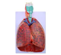 Modèle anatomique en forme de cœur et de gorge pour étude, conférences médicales, démonstrations d'anatomie de la trachée, anatomie du cœur pour l'éducation, ensemble avec pathologies pour étudiants