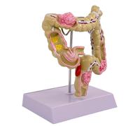 Modèle anatomique humain Grand modèle intestinal Pathologies humaines du Grand Modèle d'intestin pour l'éducation scientifique Modèle d'anatomie humaine Modèle pour l'étude scolaire
