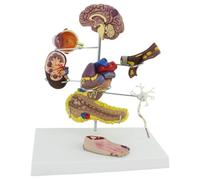 Modèle Anatomique Humain Modèles scientifiques d'anatomie Humaine Diabète Organe Modèle pathologique Complication Cérébral Cœur Pancréa