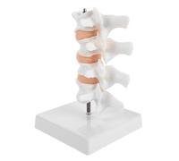 Modèle Anatomique Miniature Colonne Lombaire en PVC Blanc pour | Aide à L’analyse Pathologique, Référence Visuelle D’anatomie, pour Chiropracteurs et Thérapeutes en Rééducation