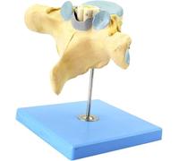 Modèle anatomique, Modèle agrandi de vertèbres cervicales humaines avec moelle épinière et nerfs spinaux modèle anatomique neuro-orthopédie enseignement