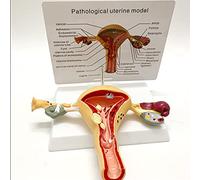 modèle anatomique, Modèle anatomique médical de l'utérus humain, modèle utérus-ovaires avec pathologies, simulation avancée la structure maternel