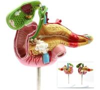 Modèle Anatomique Pathologique 1:1 du Pancréas, De La Rate, du Duodénum Et De La Vésicule Biliaire pour La Formation Médicale Et Le Traitement Médical Auxiliair