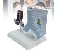 Modèle anatomique pathologique de bronches humaines, modèle comparatif entre bronches fumeuses et bronches saines destiné à l'étude et à l'enseignement