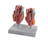 Modèle anatomique pathologique de la thyroïde, modèle d'anatomie de la thyroïde pathologique humaine, aide pédagogique pour démonstration clinique éducative