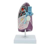 Modèle anatomique pathologique du poumon humain, détachable, illustrant le poumon du fumeur, l'abcès, la tuberculose, la pneumonie et le cancer. Humain Amovible des