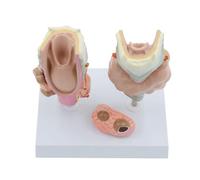 Modèle anatomique pathologique grandeur nature du larynx et de la thyroïde : étude clinique des organes gorge présentant pathologies