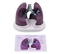 Modèle anatomique pathologique pulmonaire normal et pathologique Modèle d'anatomie pulmonaire pour l'enseignement de la recherche clinique en PVC