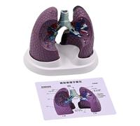 Modèle anatomique pathologique pulmonaire normal et pathologique pour l'enseignement de la recherche clinique Anatomie réaliste