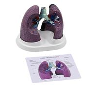 Modèle anatomique pathologique pulmonaire normal et pathologique pour l'enseignement de la recherche et les paramètres cliniques