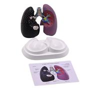 Modèle anatomique pulmonaire humain Anatomie normale et pathologique pour les paramètres cliniques Rapport d'enseignement et de conférence