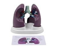 Modèle anatomique pulmonaire humain Modèle d'anatomie normale et pathologique pour les contextes cliniques Rapport d'enseignement et de conférence Anatomie