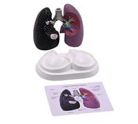 Modèle anatomique pulmonaire humain Modèle d'anatomie pulmonaire normale et pathologique pour les paramètres cliniques Rapport d'enseignement et de conférence Étude d'anatomie