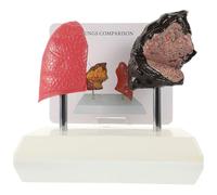 Modèle Anatomique Pulmonaire Médical en PVC pour Enseignement | Comparaison Fumeur, Aspect Réaliste, Usage en Anatomie et Physiologie, pour Étudiants