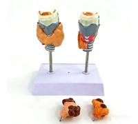Modèle Anatomique Thyroïdien Détachable de la Thyroïde Avec Base, Modèle Réaliste de Kyste Tumoral de la Gorge de la Thyroïde Humaine, en PVC, Modèle de la Thyroïde pour la Communication