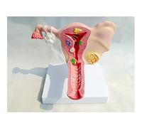 Modèle anatomique, Utérin et ovaires Organe génital féminin Modèle anatomique d'ovaires d'utérus de gynécologie for l'éducation médicale