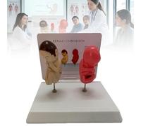 Modèle comparatif de bébés fumeurs, modèle anatomique comparant un fœtus sain et un fœtus pathologique, avec support d'exposition. Outil pédagogique pour la santé pendant la grossesse dans les
