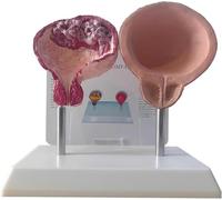 Modèle comparatif de la vessie du fumeur et de la vessie saine | Modèle d'Anatomie Comparée de la Vessie Humaine, d'Exposition de la Vessie à l'Échelle Réelle sur l'Influence du Tabac