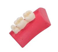 Modèle D’anatomie Canalaire Transparent en Résine pour Obturation | Pratique Répétable, Surface Lisse, pour Étudiants en Odontologie, Écoles et Stages Pratiques