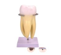 Modèle d ' anatomie dentaire, modèle de dents molaires pour l ' étude des maladies dentaires, structure dentaire humaine