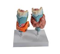 Modèle d ' anatomie pathologique de la thyroïde avec pièces amovibles, modèle anatomique d ' organe auditif pour rapport de cours anatomique