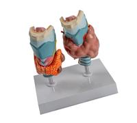 Modèle d ' anatomie pathologique de la thyroïde avec pièces amovibles pour rapport de cours à usage éducatif, modèle anatomique de la thyroïde éducatif