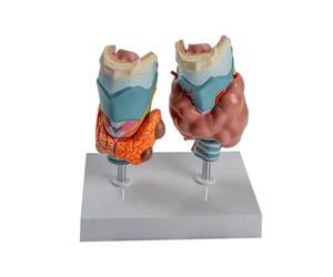 Modèle d ' anatomie pathologique de la thyroïde avec pièces amovibles pour rapport de cours à usage éducatif, modèle anatomique de la thyroïde pathologie humaine