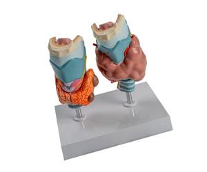 Modèle d ' anatomie pathologique de la thyroïde pour le rapport de | Pièces amovibles pour usage éducatif et démonstration, modèle anatomique de thyroïde pour l ' enseignement