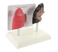 Modèle D’anatomie Pulmonaire Éducatif Réaliste en Pvc pour Étudiants | Enseignement Physiologie L’anatomie, Modèle de Poumon de Fumeur, Usage Scolaire