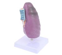 Modèle D’anatomie Pulmonaire Pathologique en Plastique pour Enseignement
