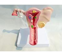 Modèle d'affichage d'anatomie vaginale utérus et ovaires organe féminin modèle Anatomique féminin gynécologie ovaires et